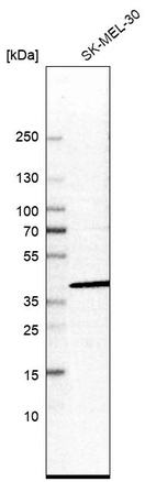 Western blot analysis in human cell line SK-MEL-30.