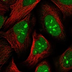 Immunofluorescent staining of human cell line U-2 OS shows localization to nucleus & nucleoli.