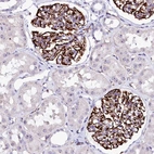 Anti-SFR1 Antibody