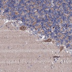 Anti-GTPBP4 Antibody