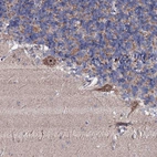 Anti-GTPBP4 Antibody
