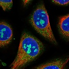 Immunofluorescent staining of human cell line U-2 OS shows positivity in nucleoli, nuclear membrane & cytoplasm.