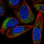 Immunofluorescent staining of human cell line PC-3 shows localization to mitochondria.