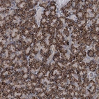 Anti-C6orf120 Antibody