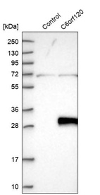 Anti-C6orf120 Antibody