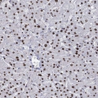 Anti-DCPS Antibody