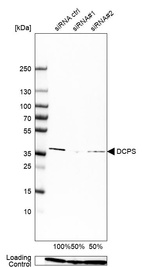 Anti-DCPS Antibody
