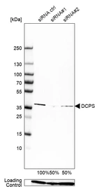 Western blot analysis in EFO-21 cells transfected with control siRNA, target specific siRNA probe #1 and #2, using Anti-DCPS antibody. Remaining relative intensity is presented. Loading control: Anti-PPIB.