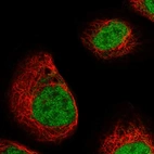 Immunofluorescent staining of human cell line A-431 shows localization to nucleoplasm.