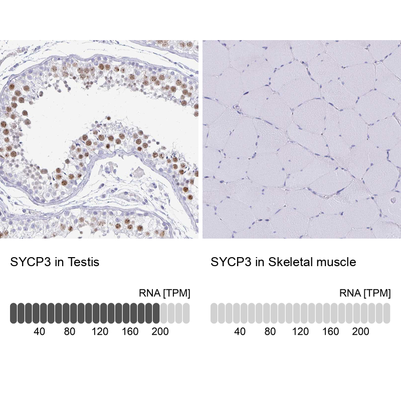 Anti-SYCP3 Antibody