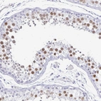 Immunohistochemical staining of human testis shows strong nuclear and nucleoli positivity in cells in seminiferous ducts.