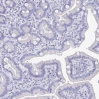 Immunohistochemical staining of human duodenum shows no positivity in glandular cells as expected.