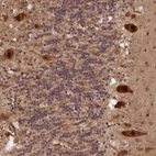 Anti-VPS51 Antibody