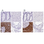 Immunohistochemical staining of human colon, liver, pancreas and testis using Anti-ERP27 antibody HPA039636 (A) shows similar protein distribution across tissues to independent antibody HPA052851 (B).