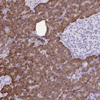 Immunohistochemical staining of human pancreas shows high expression.