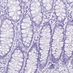 Immunohistochemical staining of human colon shows low expression as expected.