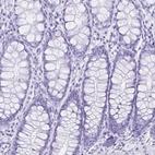 Immunohistochemical staining of human colon shows low expression as expected.