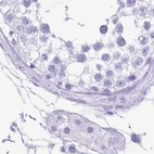 Immunohistochemical staining of human testis using Anti-ERP27 antibody HPA039636.