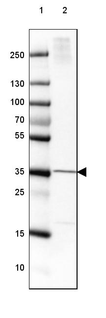 Anti-FAM107B Antibody