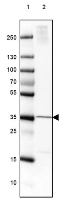 Anti-FAM107B Antibody