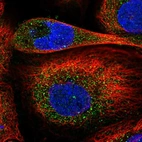 Immunofluorescent staining of human cell line A-431 shows localization to cytosol.