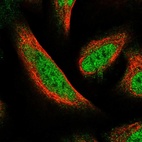 Immunofluorescent staining of human cell line U-2 OS shows localization to nucleoplasm.