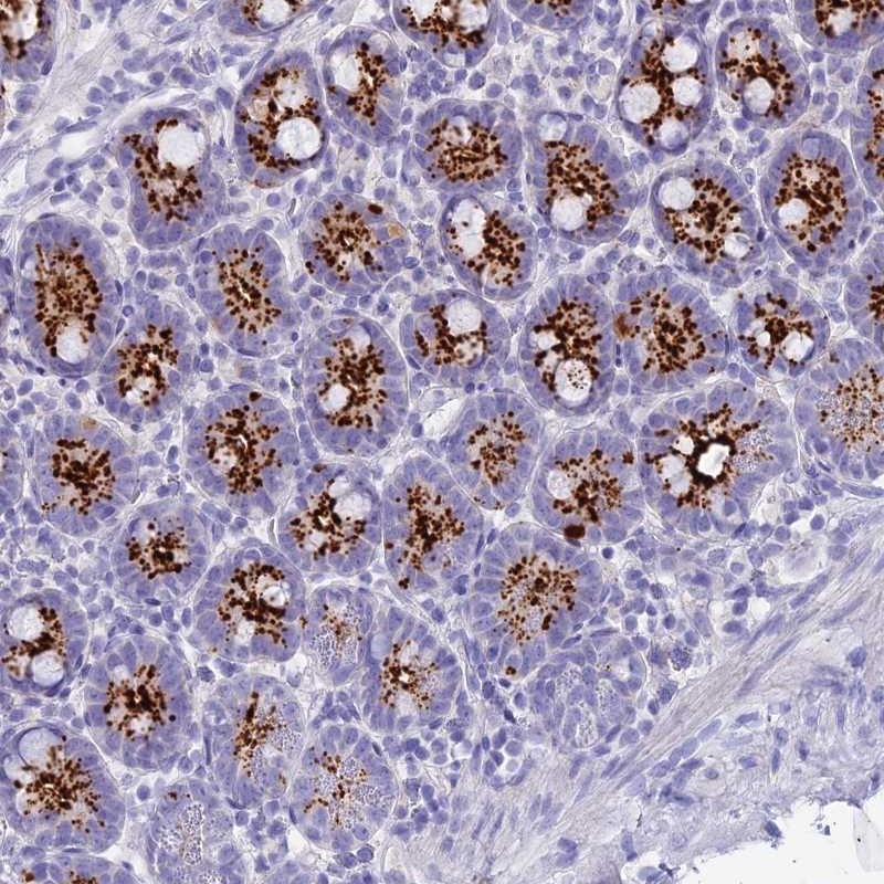 Anti-C12orf29 Antibody