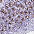 Anti-C12orf29 Antibody