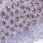 Anti-C12orf29 Antibody