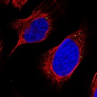Immunofluorescent staining of human cell line U-2 OS shows localization to vesicles.