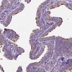 Immunohistochemical staining of human fallopian tube shows high expression.