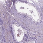 Immunohistochemical staining of human prostate shows low expression as expected.