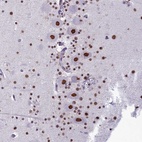 Anti-PARPBP Antibody