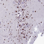 Anti-PARPBP Antibody