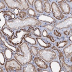Anti-RASSF9 Antibody