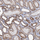 Anti-RASSF9 Antibody