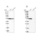 Western blot analysis using Anti-RASSF9 antibody HPA039678 (A) shows similar pattern to independent antibody HPA039428 (B).