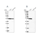 Western blot analysis using Anti-RASSF9 antibody HPA039678 (A) shows similar pattern to independent antibody HPA039428 (B).