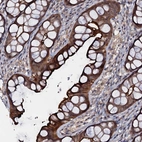 Anti-MANSC4 Antibody