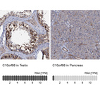 Anti-C10orf88 Antibody