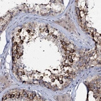 Immunohistochemical staining of human testis shows high expression.