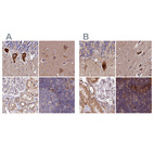 Anti-SPRYD3 Antibody