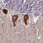 Anti-SPRYD3 Antibody