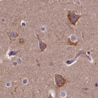 Immunohistochemical staining of human cerebral cortex using Anti-SPRYD3 antibody HPA039685.