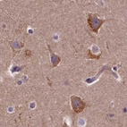 Anti-SPRYD3 Antibody