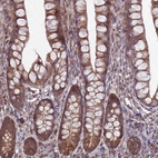 Immunohistochemical staining of human small intestine shows strong cytoplasmic positivity in glandular cells.