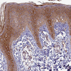 Immunohistochemical staining of human skin shows moderate to strong cytoplasmic positivity in squamous epithelial cells.