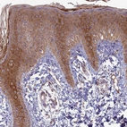 Immunohistochemical staining of human skin shows moderate to strong cytoplasmic positivity in squamous epithelial cells.