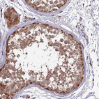 Immunohistochemical staining of human testis shows strong cytoplasmic positivity in cells in seminiferous ducts.