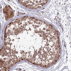 Immunohistochemical staining of human testis shows strong cytoplasmic positivity in cells in seminiferous ducts.